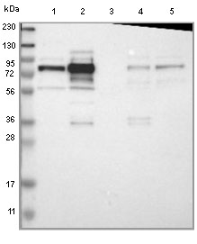 Western blot - Anti-GRAMD1C antibody (AB121365)