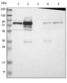 Western blot - Anti-GRAMD1C antibody (AB121365)