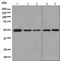 Western blot - Anti-GRAMD2 antibody [EPR10060] (AB154861)