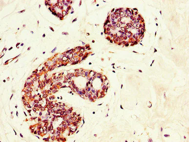 Immunohistochemistry (Formalin/PFA-fixed paraffin-embedded sections) - Anti-GRAMD4 antibody (AB234649)