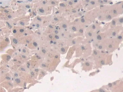 Immunohistochemistry (Formalin/PFA-fixed paraffin-embedded sections) - Anti-Grancalcin antibody (AB231632)