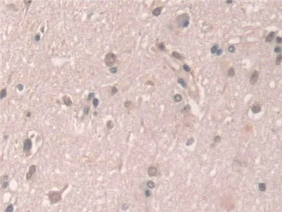 Immunohistochemistry (Formalin/PFA-fixed paraffin-embedded sections) - Anti-Grancalcin antibody (AB231632)