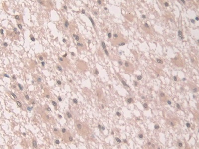 Immunohistochemistry (Formalin/PFA-fixed paraffin-embedded sections) - Anti-Grancalcin antibody (AB231632)