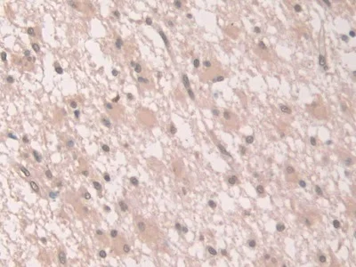 Immunohistochemistry (Formalin/PFA-fixed paraffin-embedded sections) - Anti-Grancalcin antibody (AB231632)