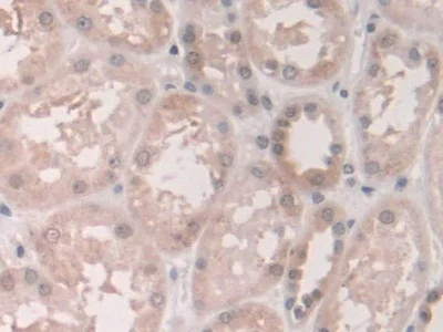 Immunohistochemistry (Formalin/PFA-fixed paraffin-embedded sections) - Anti-Grancalcin antibody (AB231632)