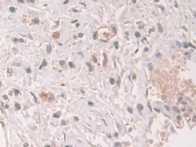 Immunohistochemistry (Formalin/PFA-fixed paraffin-embedded sections) - Anti-Grancalcin antibody (AB231632)