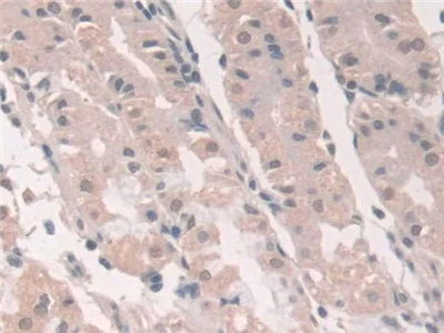 Immunohistochemistry (Formalin/PFA-fixed paraffin-embedded sections) - Anti-Grancalcin antibody (AB231632)