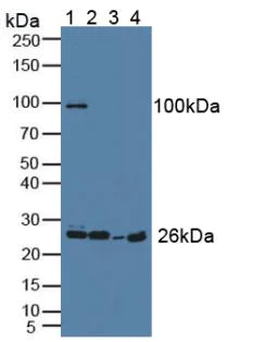 Western blot - Anti-Grancalcin antibody (AB231632)