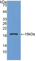 Western blot - Anti-Grancalcin antibody (AB231632)