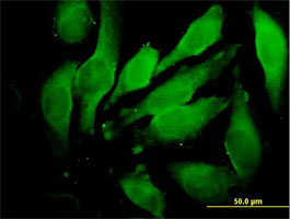 Immunocytochemistry/ Immunofluorescence - Anti-Granulin antibody (AB169325), expandable thumbnail