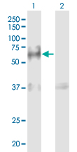 Western blot - Anti-Granulin antibody (AB169325), expandable thumbnail