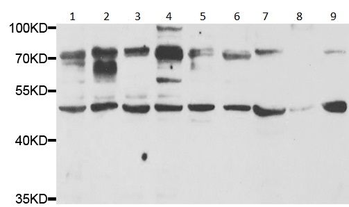 Western blot - Anti-Granulin antibody (AB191211), expandable thumbnail