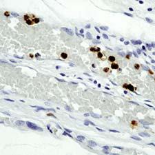 Immunohistochemistry (Formalin/PFA-fixed paraffin-embedded sections) - Anti-Granulocytes antibody [SPM250] (AB75701)