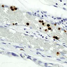 Immunohistochemistry (Formalin/PFA-fixed paraffin-embedded sections) - Anti-Granulocytes antibody [SPM250] (AB75701)