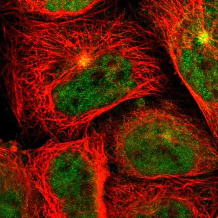 Immunocytochemistry/ Immunofluorescence - Anti-Granuphilin antibody (AB224047)