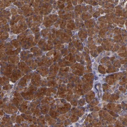 Immunohistochemistry (Formalin/PFA-fixed paraffin-embedded sections) - Anti-Granuphilin antibody (AB224047)