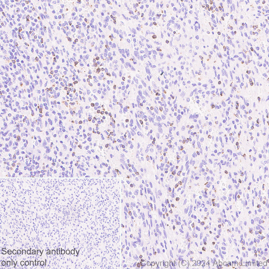 Immunohistochemistry (Formalin/PFA-fixed paraffin-embedded sections) - Anti-Granzyme A antibody [RM2061] (ab322896), expandable thumbnail