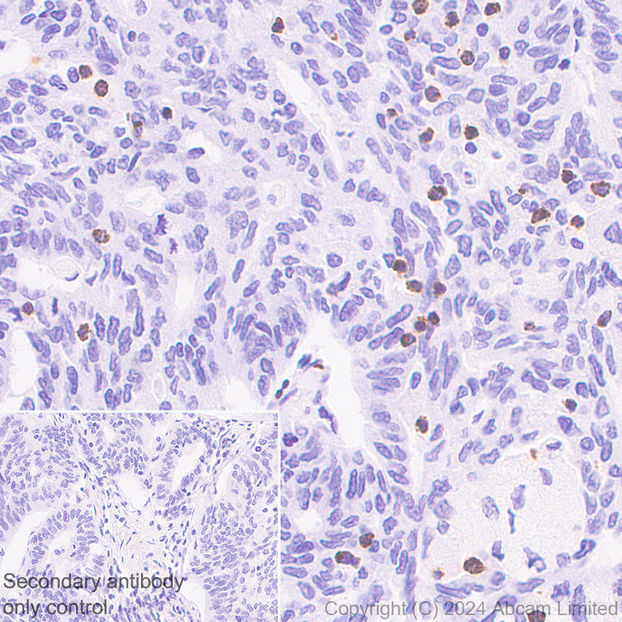 Immunohistochemistry (Formalin/PFA-fixed paraffin-embedded sections) - Anti-Granzyme A antibody [RM2061] (ab322896), expandable thumbnail