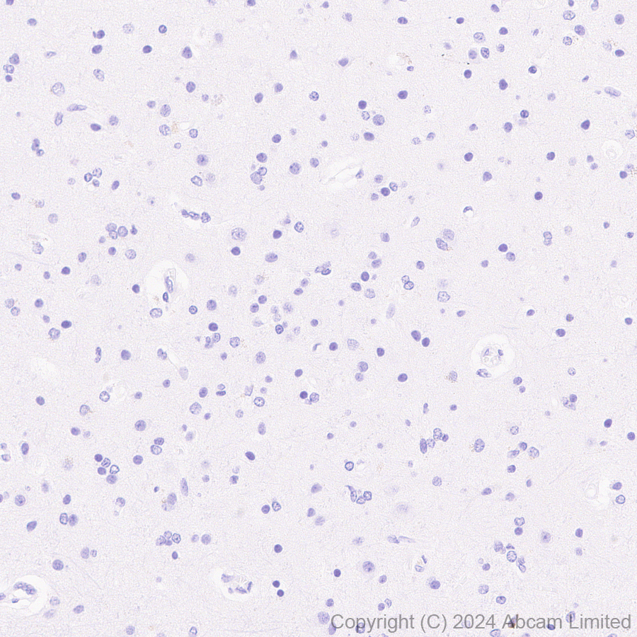 Immunohistochemistry (Formalin/PFA-fixed paraffin-embedded sections) - Anti-Granzyme A antibody [RM2061] (ab322896), expandable thumbnail