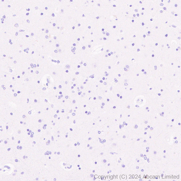 Immunohistochemistry (Formalin/PFA-fixed paraffin-embedded sections) - Anti-Granzyme A antibody [RM2061] (AB322896)