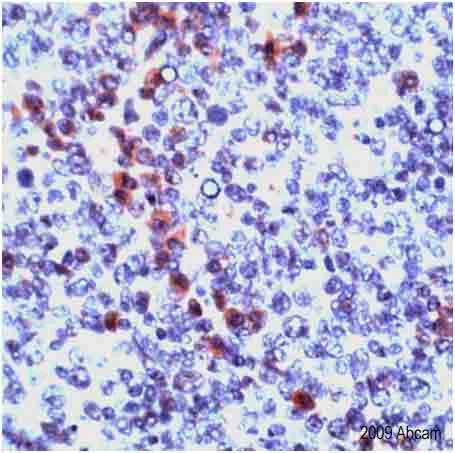 Immunohistochemistry (Formalin/PFA-fixed paraffin-embedded sections) - Anti-Granzyme B antibody (AB4059)