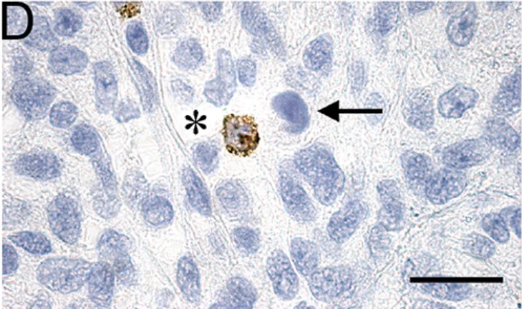 Immunohistochemistry (Formalin/PFA-fixed paraffin-embedded sections) - Anti-Granzyme B antibody (AB4059)