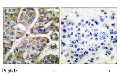 Immunohistochemistry (Formalin/PFA-fixed paraffin-embedded sections) - Anti-Granzyme B antibody (AB53097)