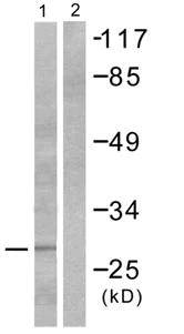 Western blot - Anti-Granzyme B antibody (AB53097)