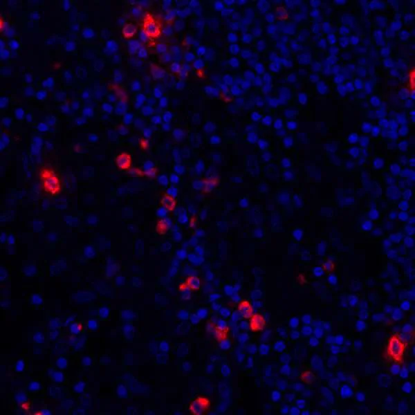 Immunohistochemistry (Formalin/PFA-fixed paraffin-embedded sections) - Anti-Granzyme B antibody [BLR022E] (AB243879)
