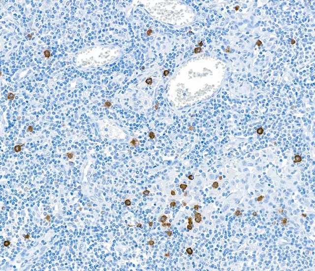 Immunohistochemistry (Formalin/PFA-fixed paraffin-embedded sections) - Anti-Granzyme B antibody [BLR022E] (AB243879)