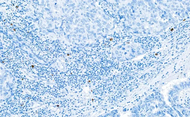 Immunohistochemistry (Formalin/PFA-fixed paraffin-embedded sections) - Anti-Granzyme B antibody [BLR022E] (AB243879)