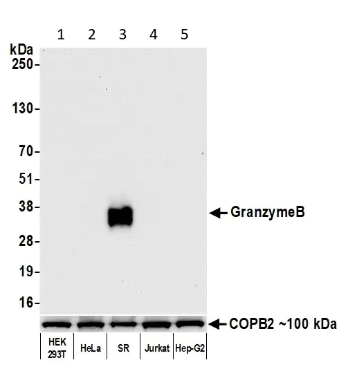 Western blot - Anti-Granzyme B antibody [BLR022E] (AB243879)