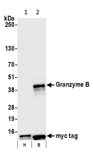 Western blot - Anti-Granzyme B antibody [BLR022E] (AB243879)