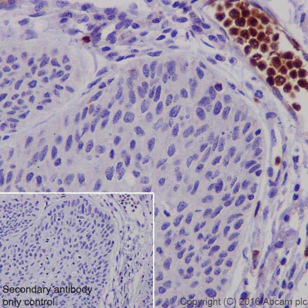 Immunohistochemistry (Formalin/PFA-fixed paraffin-embedded sections) - Anti-Granzyme B antibody [EPR20129-217] (AB208586), expandable thumbnail