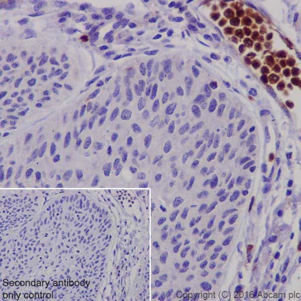 Immunohistochemistry (Formalin/PFA-fixed paraffin-embedded sections) - Anti-Granzyme B antibody [EPR20129-217] (AB208586)