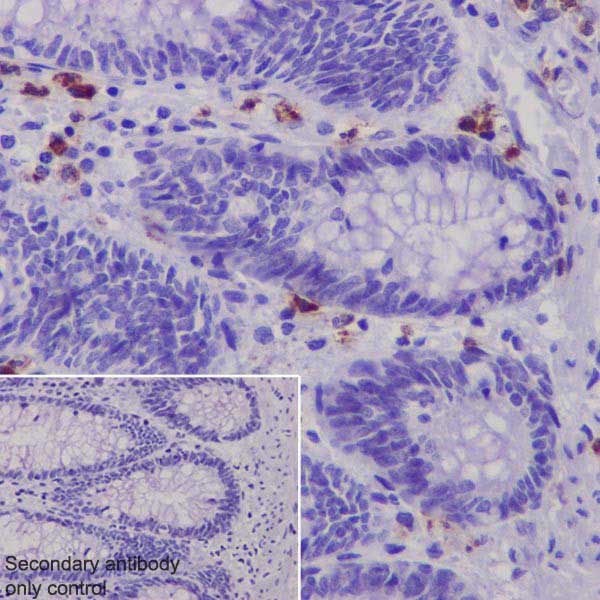 Immunohistochemistry (Formalin/PFA-fixed paraffin-embedded sections) - Anti-Granzyme B antibody [EPR20129-217] (AB208586), expandable thumbnail