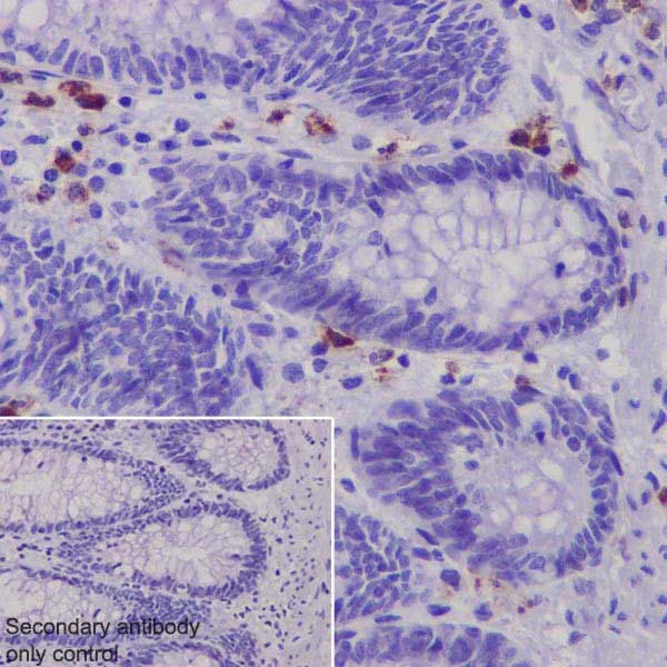 Immunohistochemistry (Formalin/PFA-fixed paraffin-embedded sections) - Anti-Granzyme B antibody [EPR20129-217] (AB208586)