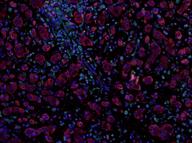 Multiplex immunohistochemistry - Anti-Granzyme B antibody [EPR20129-217] (AB208586), expandable thumbnail