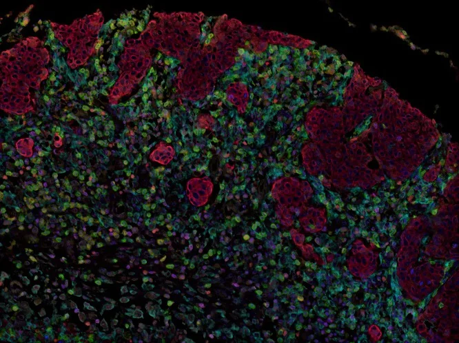 Multiplex immunohistochemistry - Anti-Granzyme B antibody [EPR20129-217] - BSA and Azide free (AB219803)