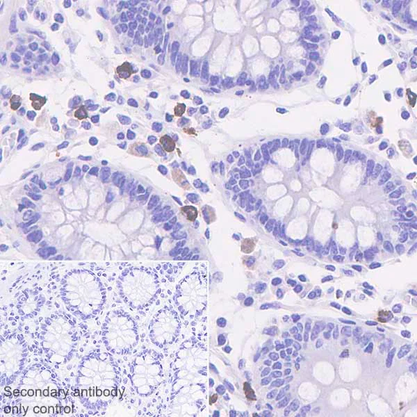 Immunohistochemistry (Formalin/PFA-fixed paraffin-embedded sections) - Anti-Granzyme B antibody [EPR22645-206] (AB255598)