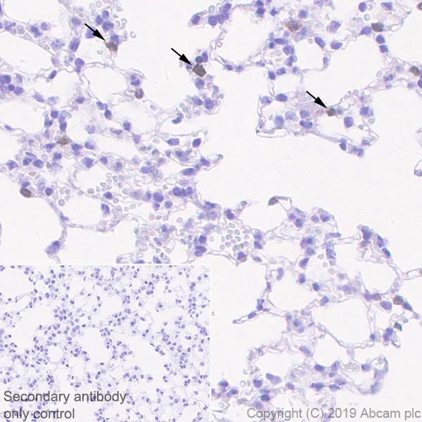 Immunohistochemistry (Formalin/PFA-fixed paraffin-embedded sections) - Anti-Granzyme B antibody [EPR22645-206] - BSA and Azide free (AB255868)