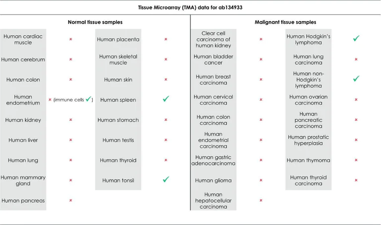 Immunohistochemistry (Formalin/PFA-fixed paraffin-embedded sections) - Anti-Granzyme B antibody [EPR8260] (AB134933)