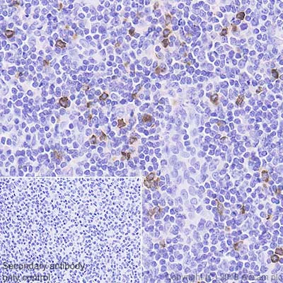 Immunohistochemistry (Formalin/PFA-fixed paraffin-embedded sections) - Anti-Granzyme B antibody [EPR8260] - Low endotoxin, Azide free (AB214443)