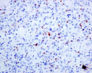 Immunohistochemistry (Formalin/PFA-fixed paraffin-embedded sections) - Anti-Granzyme B antibody [EPR8260] - Low endotoxin, Azide free (AB214443)