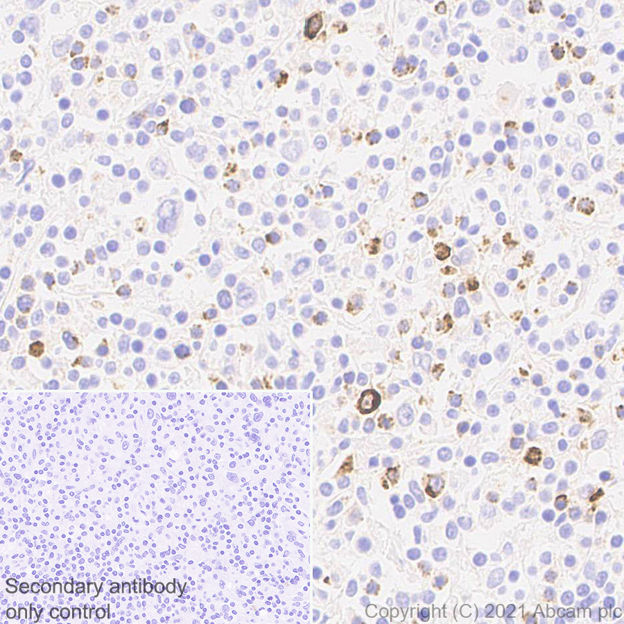 Immunohistochemistry (Formalin/PFA-fixed paraffin-embedded sections) - Anti-Granzyme B antibody [EPR8260] - Mouse IgG1 (Chimeric) - BSA and Azide free (AB283337), expandable thumbnail