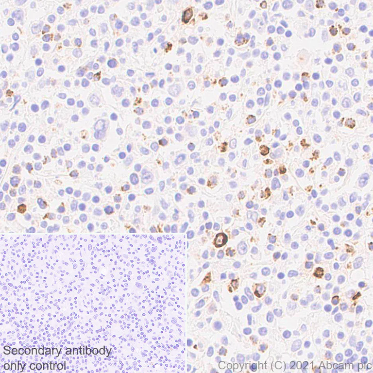 Immunohistochemistry (Formalin/PFA-fixed paraffin-embedded sections) - Anti-Granzyme B antibody [EPR8260] - Mouse IgG1 (Chimeric) - BSA and Azide free (AB283337)