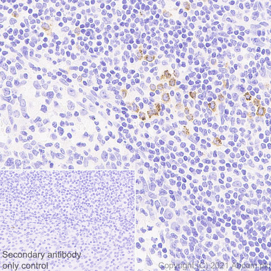 Immunohistochemistry (Formalin/PFA-fixed paraffin-embedded sections) - Anti-Granzyme B antibody [EPR8260] - Mouse IgG1 (Chimeric) - BSA and Azide free (AB283337), expandable thumbnail