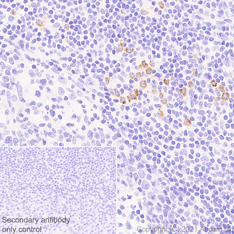 Immunohistochemistry (Formalin/PFA-fixed paraffin-embedded sections) - Anti-Granzyme B antibody [EPR8260] - Mouse IgG1 (Chimeric) - BSA and Azide free (AB283337)