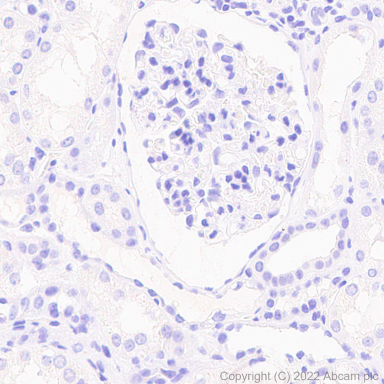 Immunohistochemistry (Formalin/PFA-fixed paraffin-embedded sections) - Anti-Granzyme B antibody [EPR8260] - Rat IgG2a (Chimeric) (AB289888)