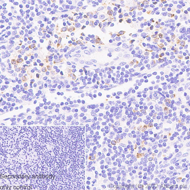Immunohistochemistry (Formalin/PFA-fixed paraffin-embedded sections) - Anti-Granzyme B antibody [EPR8260] - Rat IgG2a (Chimeric) (AB289888)